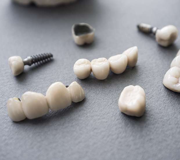 King George The Difference Between Dental Implants and Mini Dental Implants